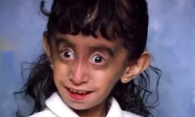she was called the “world’s ugliest woman”… then she shocked the world with her comeback