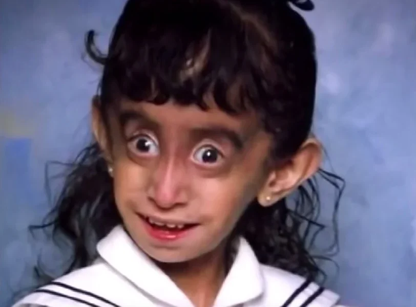she was called the “world’s ugliest woman”… then she shocked the world with her comeback
