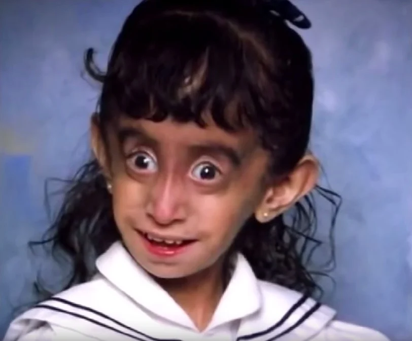 she was called the “world’s ugliest woman”… then she shocked the world with her comeback